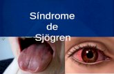 Enferm Sindrome de Sjogren