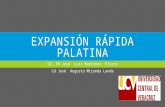 Expansion Palatina Rapida