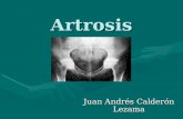 Tema 1 Artrosis