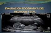 Curso US en GO Lec 12 NeurosonografÃ-A Fetal