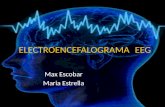 Electroencefalograma (EEG) (1)