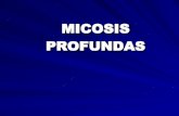 Presentacion Micosis Profundas UPAV Mario