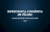 Hipertrofia Pilorica y Obstrucción Intestinal