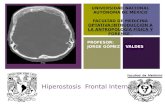 Antropología :Hiperostosis frontal interna