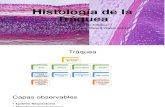 Traquea (histología).pptx