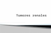 Carcinoma células renales Localizado.pptx