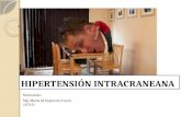 Síndrome de Hipertensión Intracraneana