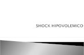 Solo Choque Hipovolemico Cirugia 2012