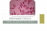 Anemia de Celulas Falciformes (Drepanocitosis)
