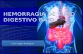 Hemorragia Digestiva Baja Clinica