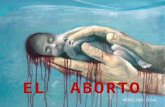 Diapositivas Sobre El Aborto Rocio Finales