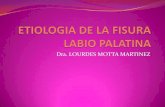 Etiologia de La Fisura Labio Palatina