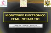 182224182 Monitoreo Electronico Fetal PDF