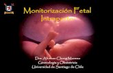C19 Monitorización Fetal Intraparto