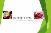 Muerte Fetal 2013
