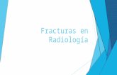 Fracturas en radiología