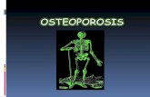 Osteoprosis terapeutica