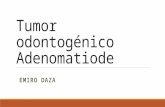 Tumor Odontogenico Adenomatoide