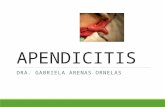 Apendicitis en niños