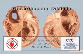 Dilatacion miocardio