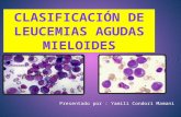 LMA clasificacion de leucemias mieloides agudas