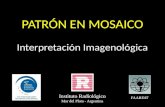 PATRÓN EN MOSAICO Interpretación Imagenológica Instituto Radiológico Mar del Plata - Argentina FAARDIT.