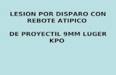 LESION POR DISPARO CON REBOTE ATIPICO DE PROYECTIL 9MM LUGER KPO.