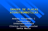 IMAGEN DE PLACAS ATEROTROMBOTICAS Andrès Fernàndez C Cardiologia intervencionista Clinica Cardiovascular Santa Maria.