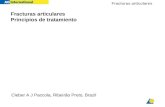Fracturas articulares Fracturas articulares Principios de tratamiento Cleber A J Paccola, Ribeirão Preto, Brazil.