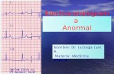 Electrocardiograma Anormal Nombre: Dr. Luizaga Luis A. Materia: Medicina Interna.