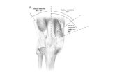 COMPARTIMENTO POSTERIOR Semimembranoso: – Flexión y rotación interna de rodilla, extensión y rotación interna de coxofemoral – Resiste la abducción.
