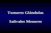 Tumores Glándulas Salivales Menores. Diagnóstico Clínico y Radiográfico.