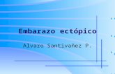 Embarazo ectópico Alvaro Santivañez P.. Esquema de presentación El problema diagnóstico El manejo del embarazo ectópico no complicado.