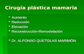 Cirugía plástica mamaria  Aumento  Reducción  Elevación  Reconstrucción-Remodelación  Dr. ALFONSO QUETGLAS MARIMÓN.