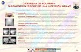 Institut Català de la Salut GANGRENA DE FOURNIER: DIAGNÓSTICO PRECOZ DE UNA INFECCIÓN GRAVE Introducción: Introducción: La gangrena de Fournier (GF) es.