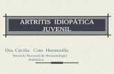 ARTRITIS IDIOPÁTICA JUVENIL Dra. Cecilia Coto Hermosilla Servicio Nacional de Reumatología Pediátrica.
