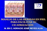 MANEJO DE LAS HERIDAS EN PIEL PARA FACILITAR SU CICATRIZACIÓN MANEJO DE LAS HERIDAS EN PIEL PARA FACILITAR SU CICATRIZACIÓN M. EN C. HORACIO JOSÉ REYES.