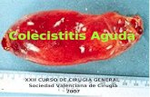 Colecistitis Aguda XXII CURSO DE CIRUGIA GENERAL Sociedad Valenciana de Cirugía 2007.