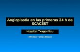 Angioplastia en las primeras 24 h de SCACEST Hospital Txagorritxu Alfonso Torres Bosco.