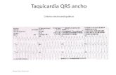 Taquicardia QRS ancho Criterios electrocardiográficos Diego Fdez Redondo.