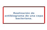 Realización de antibiograma de una cepa bacteriana.