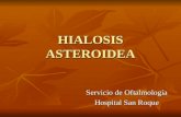 HIALOSIS ASTEROIDEA Servicio de Oftalmología Hospital San Roque.