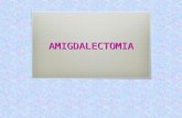 AMIGDALECTOMIA. Identificacion y Descripcion del Procedimiento  La Amigdalectomia es la intervencion quirurgica en la que se extirpan las amigdalas situadas.