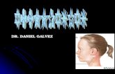 DR. DANIEL GALVEZ. refiere a un trastorno inespecífico refiere a un trastorno inespecífico de los ganglios linfáticos. de los ganglios linfáticos. sinónimo.