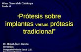 “ Prótesis sobre implantes versus prótesis tradicional” Dr. Miguel Ángel Carreño Hernández Postgrado Prótesis Bucal U.B. drmacarreno@yahoo.es Mútua General.