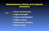 Manifestaciones clínicas de la isquemia miocárdica Infarto del Miocardio Angina Inestable Angina Vasoespástica Angina Crónica Insuficiencia Cardíaca Muerte.
