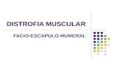 DISTROFIA MUSCULAR FACIO-ESCAPULO-HUMERAL.  Concepto de Distrofia muscular Grupo de enfermedades, todas hereditarias, caracterizadas por una debilidad.