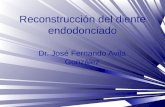 Reconstrucción del diente endodonciado Dr. José Fernando Avila González.