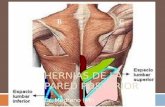 HERNIAS DE LA PARED POSTERIOR Dr. Medrano (MI). Introduccion  Se denominan hernias lumbares a las que se desarrollan en la región comprendida entre la.