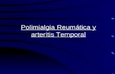 Polimialgia Reumática y arteritis Temporal. Polimialgia Reumática: se refiere a un síndrome doloroso, habitualmente en pacientes mayores con elevación.